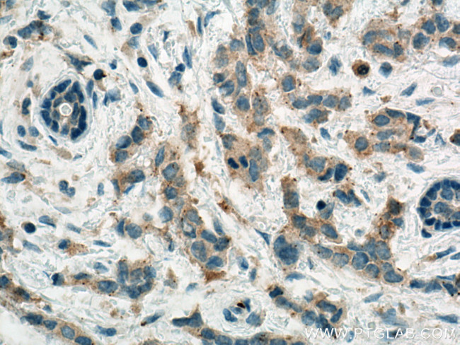 ACC Antibody in Immunohistochemistry (Paraffin) (IHC (P))