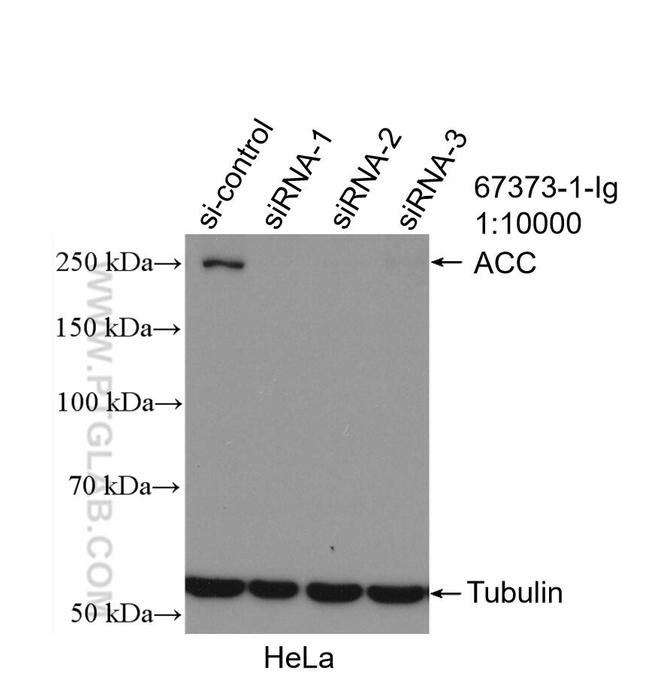 ACC Antibody in Western Blot (WB)