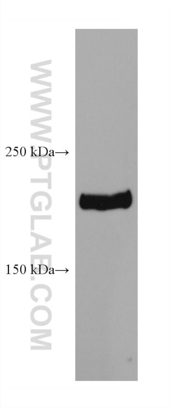 BRD4 Antibody in Western Blot (WB)