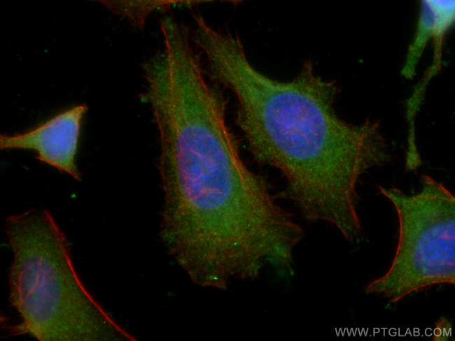 TSG101 Antibody in Immunocytochemistry (ICC/IF)