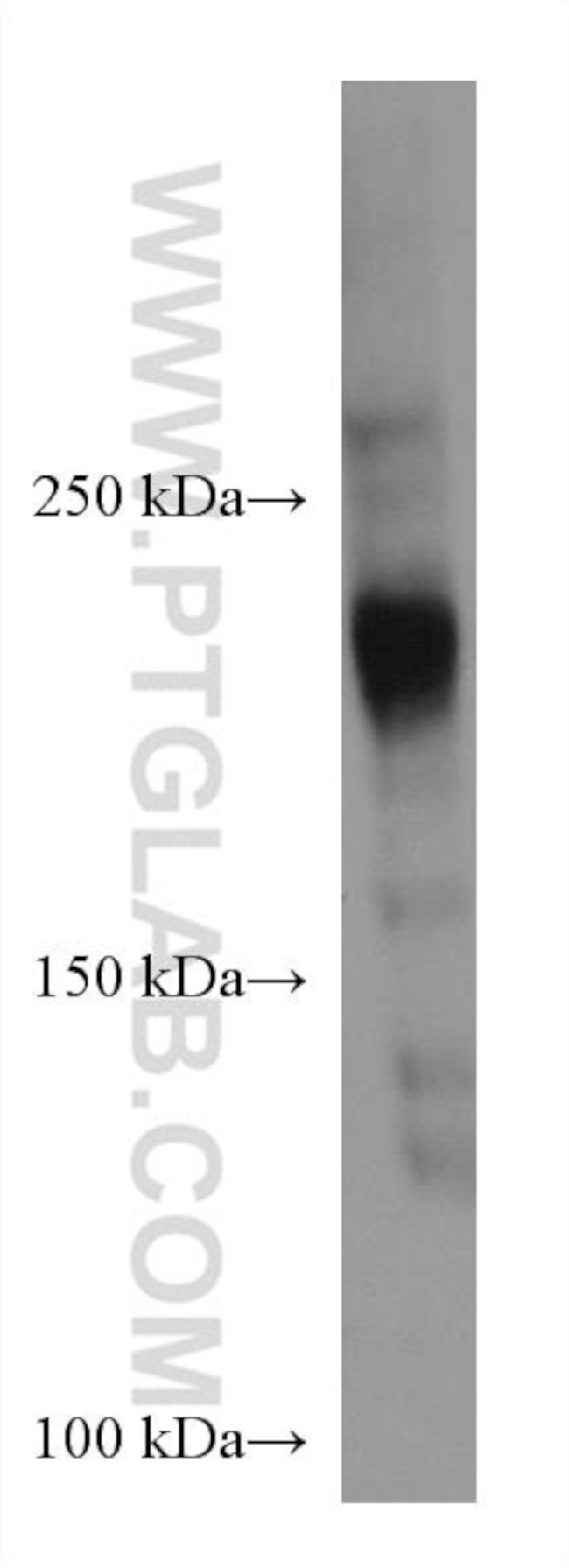 ARID4B Antibody in Western Blot (WB)