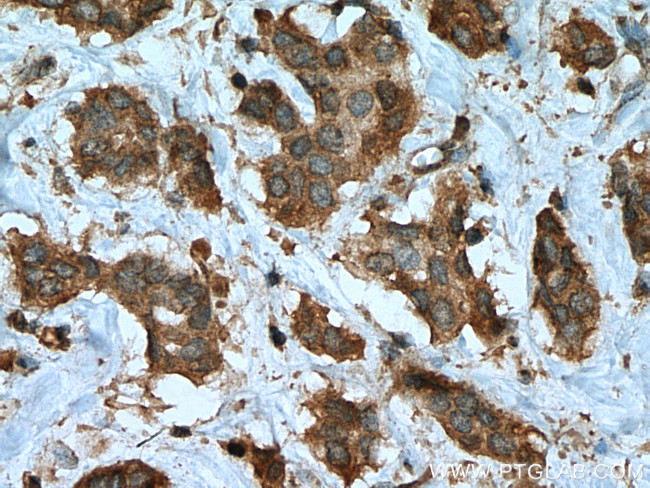 PTPN2 Antibody in Immunohistochemistry (Paraffin) (IHC (P))