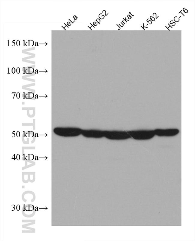 PTPN2 Antibody in Western Blot (WB)