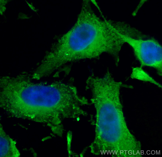 PFN1 Antibody in Immunocytochemistry (ICC/IF)