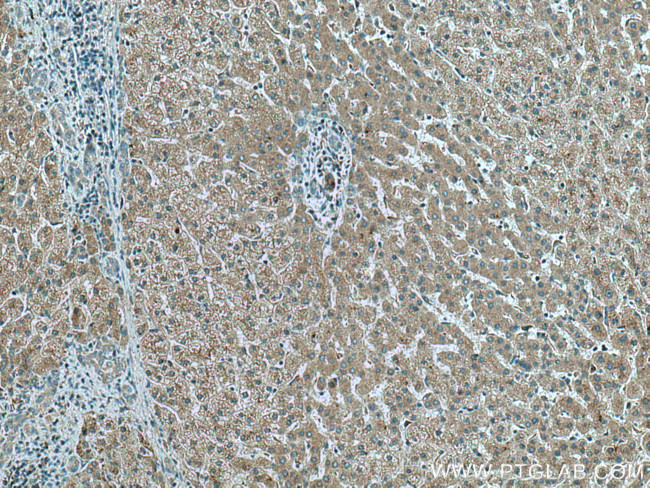 FGL1 Antibody in Immunohistochemistry (Paraffin) (IHC (P))