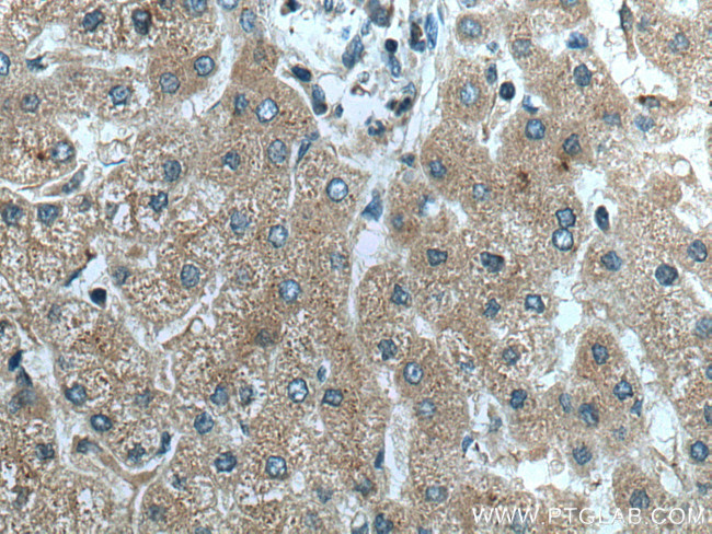 FGL1 Antibody in Immunohistochemistry (Paraffin) (IHC (P))