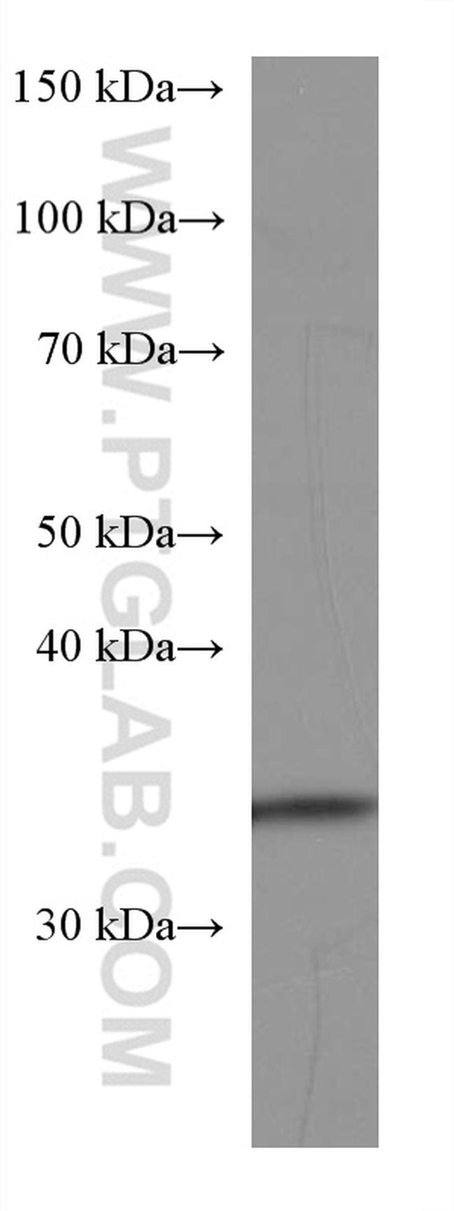 FGL1 Antibody in Western Blot (WB)