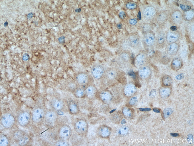 RGS14 Antibody in Immunohistochemistry (Paraffin) (IHC (P))