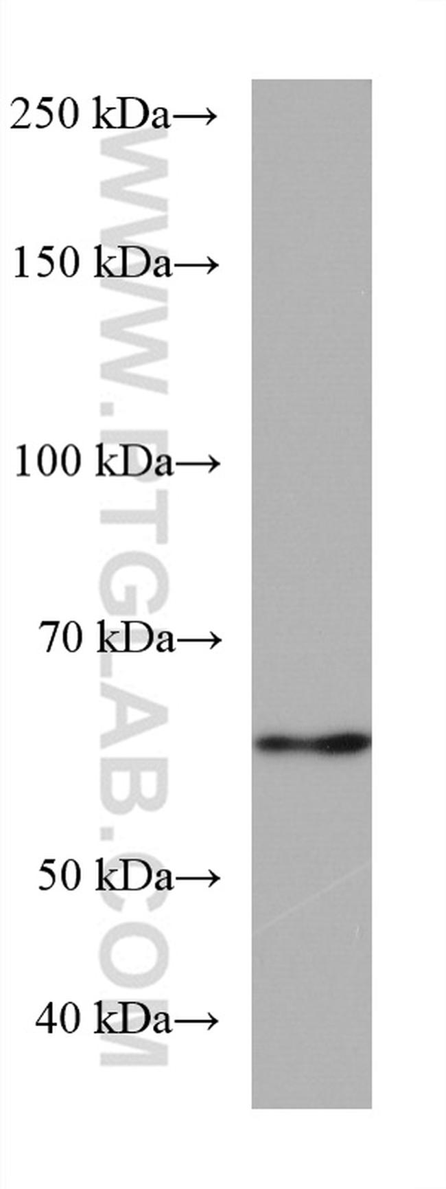 RGS14 Antibody in Western Blot (WB)