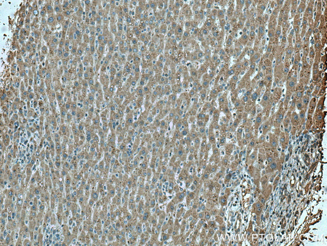 LACTB2 Antibody in Immunohistochemistry (Paraffin) (IHC (P))