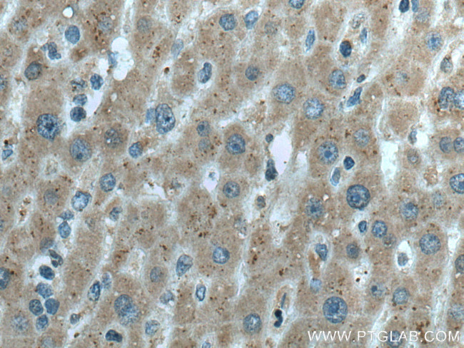 LACTB2 Antibody in Immunohistochemistry (Paraffin) (IHC (P))