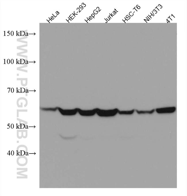 CCT5 Antibody in Western Blot (WB)