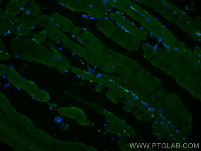 TRIM72 Antibody in Immunohistochemistry (PFA fixed) (IHC (PFA))