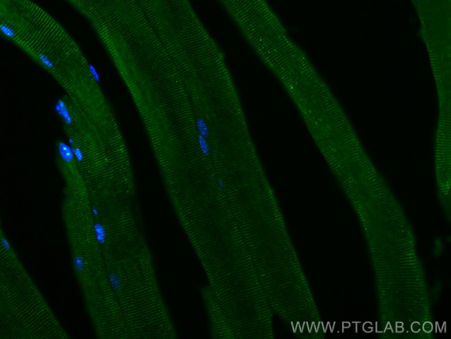 TRIM72 Antibody in Immunohistochemistry (PFA fixed) (IHC (PFA))