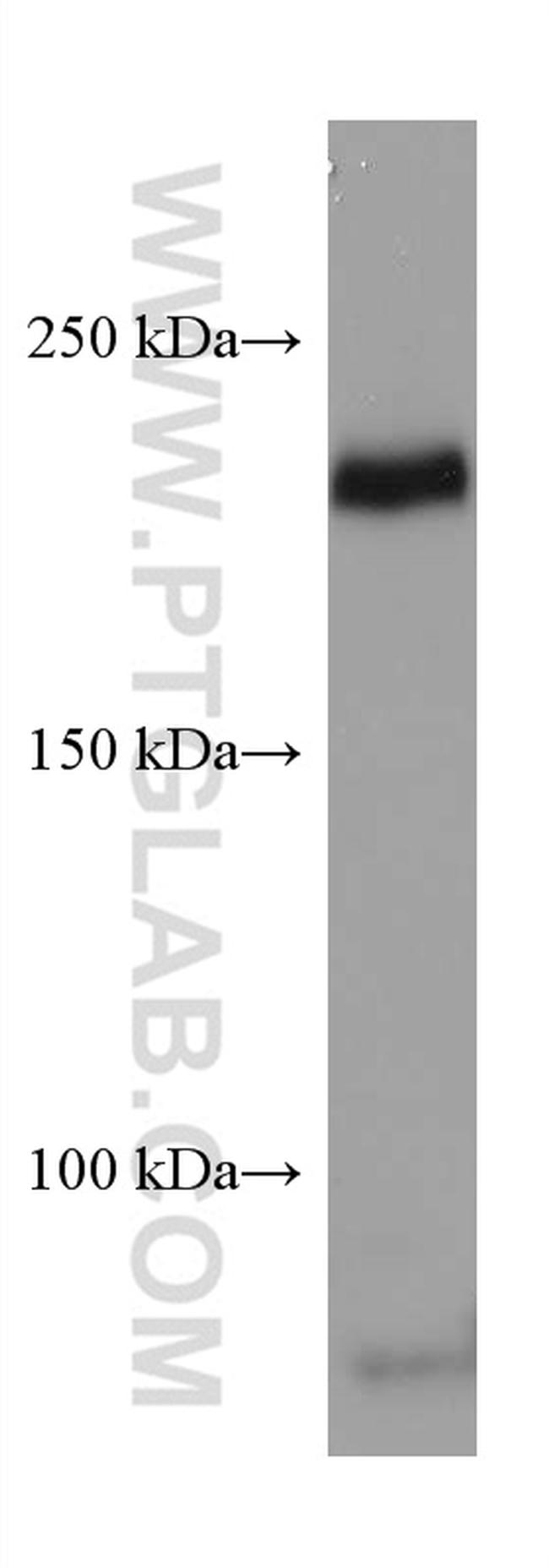 VEGFR2 Antibody in Western Blot (WB)