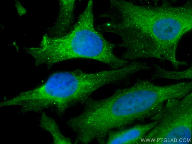 MAP2K2 Antibody in Immunocytochemistry (ICC/IF)