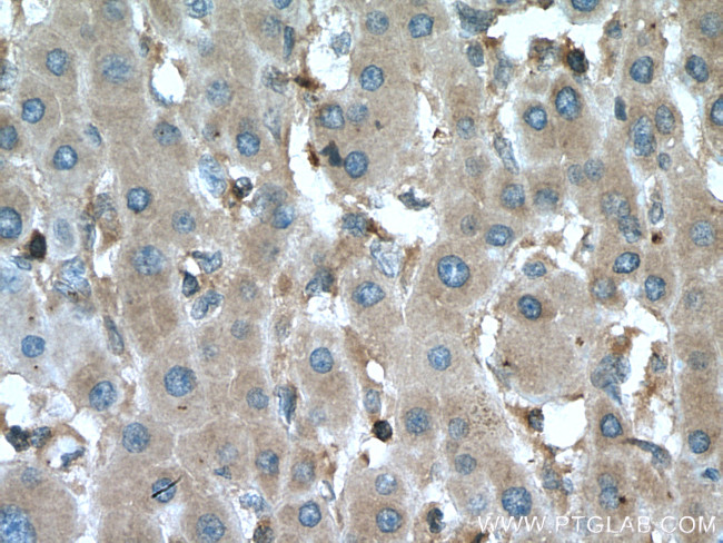 MAP2K2 Antibody in Immunohistochemistry (Paraffin) (IHC (P))