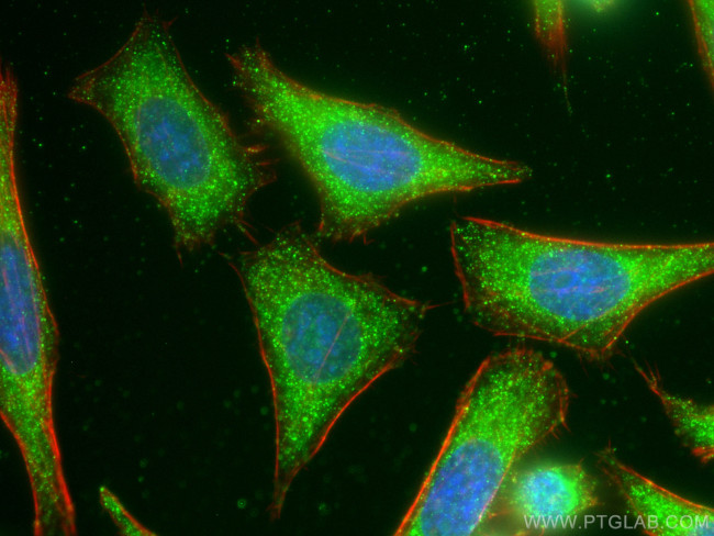 TYK2 Antibody in Immunocytochemistry (ICC/IF)