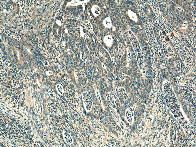 TYK2 Antibody in Immunohistochemistry (Paraffin) (IHC (P))