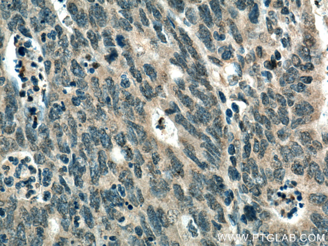 TYK2 Antibody in Immunohistochemistry (Paraffin) (IHC (P))