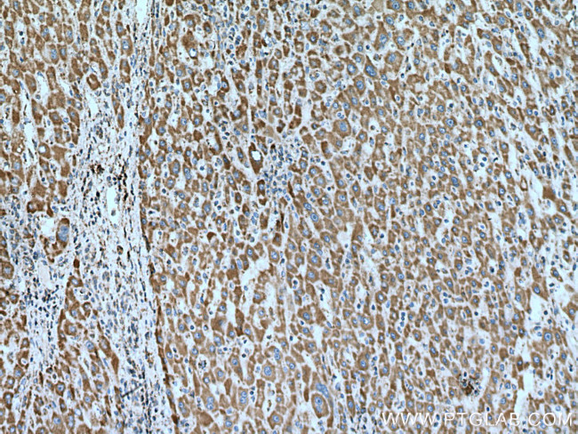 GRIM19 Antibody in Immunohistochemistry (Paraffin) (IHC (P))