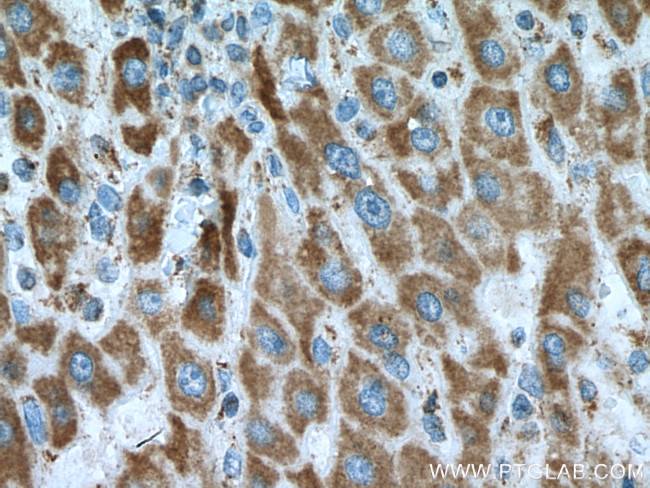 GRIM19 Antibody in Immunohistochemistry (Paraffin) (IHC (P))