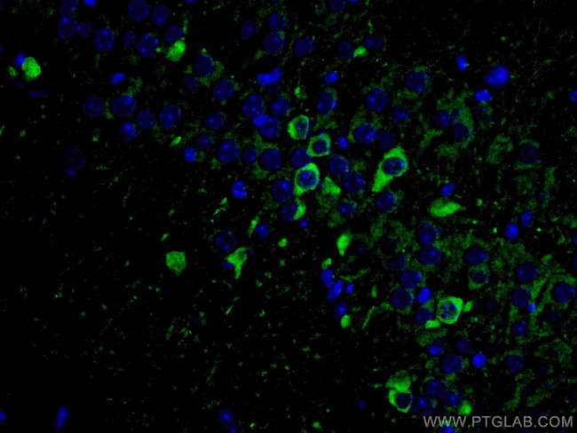 ACVR1 Antibody in Immunohistochemistry (Paraffin) (IHC (P))