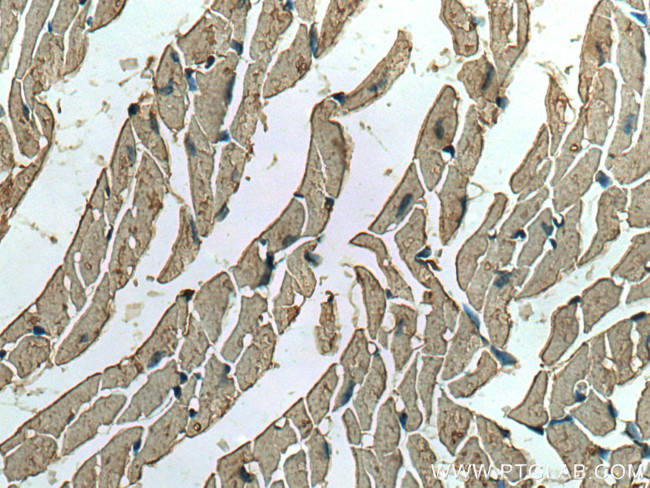 ACVR1 Antibody in Immunohistochemistry (Paraffin) (IHC (P))