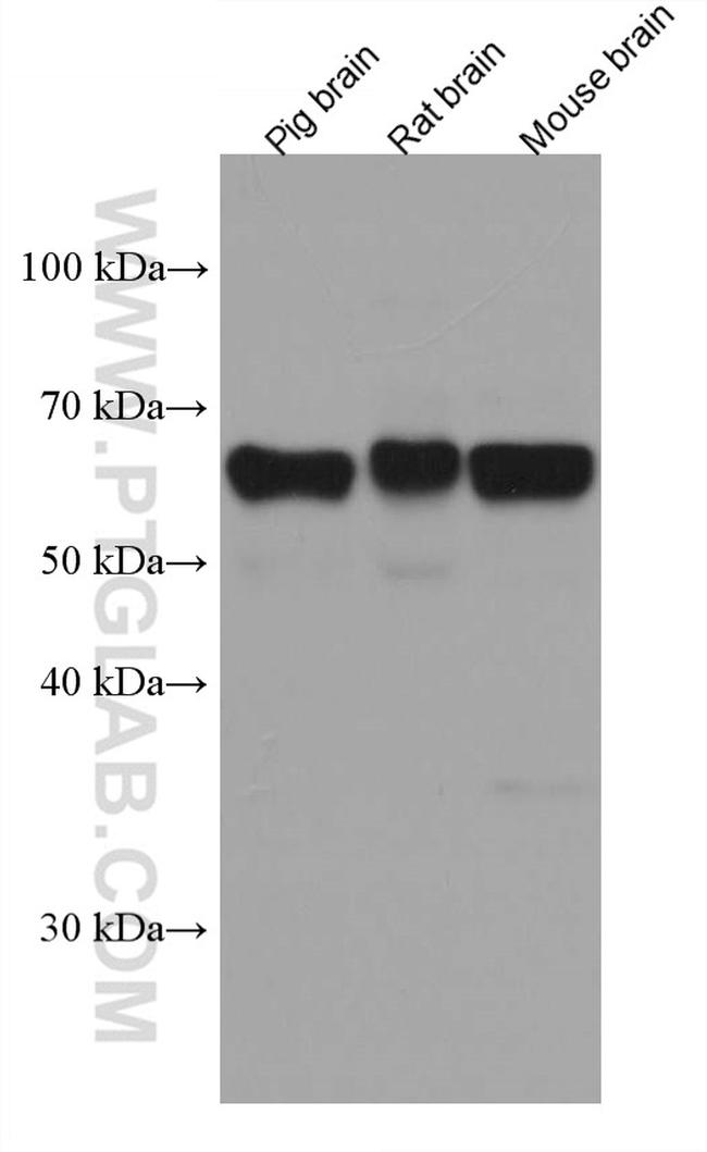 ACVR1 Antibody in Western Blot (WB)