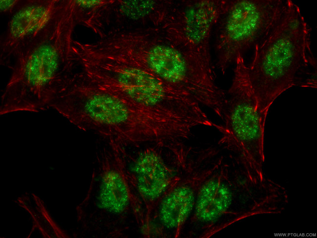 RBM39 Antibody in Immunocytochemistry (ICC/IF)