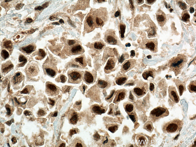 RBM39 Antibody in Immunohistochemistry (Paraffin) (IHC (P))