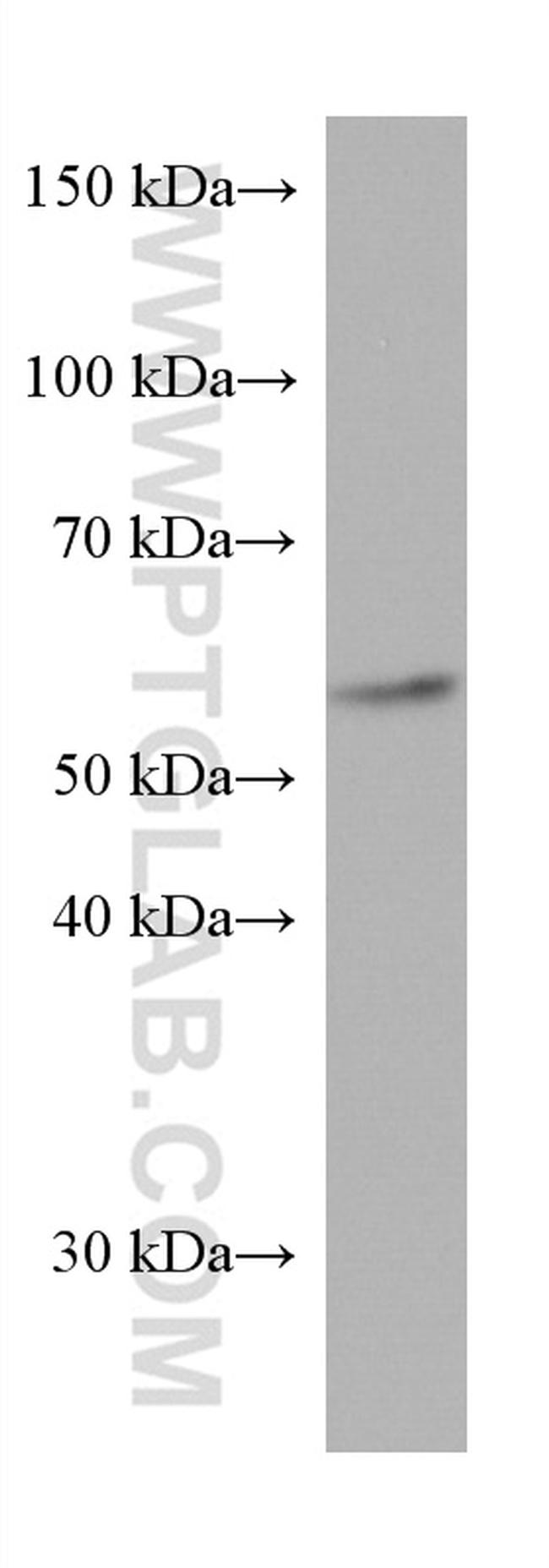 CYP21A2 Antibody in Western Blot (WB)