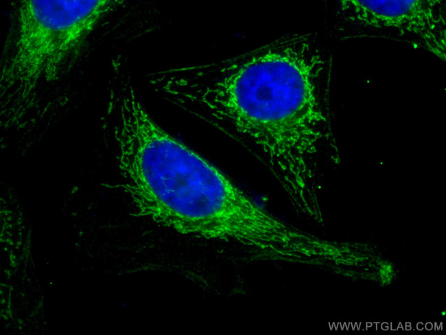 Sam50 Antibody in Immunocytochemistry (ICC/IF)