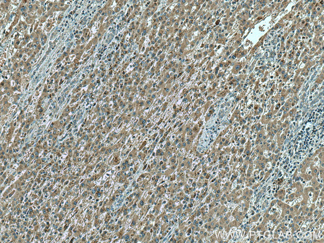 Sam50 Antibody in Immunohistochemistry (Paraffin) (IHC (P))