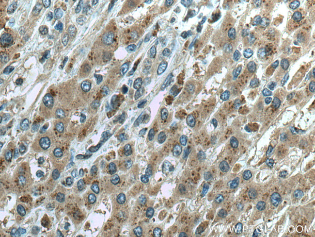 Sam50 Antibody in Immunohistochemistry (Paraffin) (IHC (P))