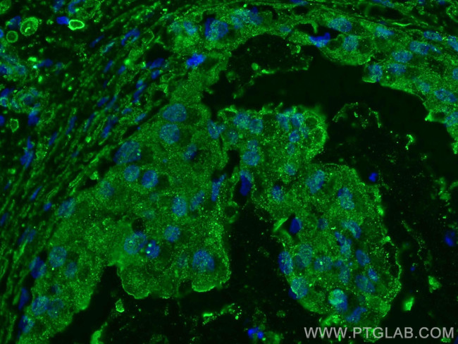 KLK11 Antibody in Immunohistochemistry (Paraffin) (IHC (P))