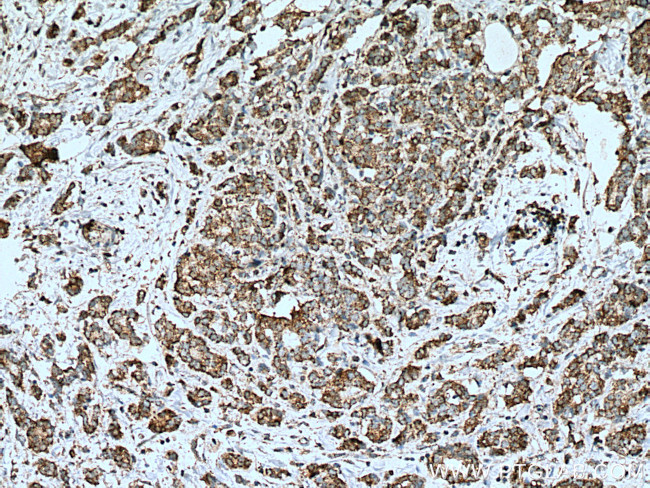 KLK11 Antibody in Immunohistochemistry (Paraffin) (IHC (P))