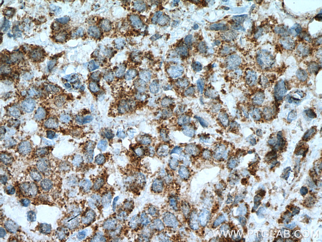 KLK11 Antibody in Immunohistochemistry (Paraffin) (IHC (P))