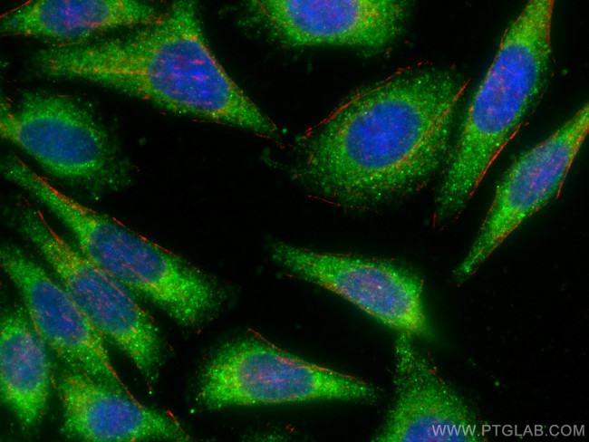 AMPD2 Antibody in Immunocytochemistry (ICC/IF)