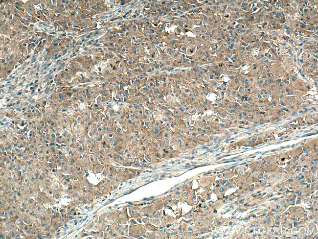 AMPD2 Antibody in Immunohistochemistry (Paraffin) (IHC (P))