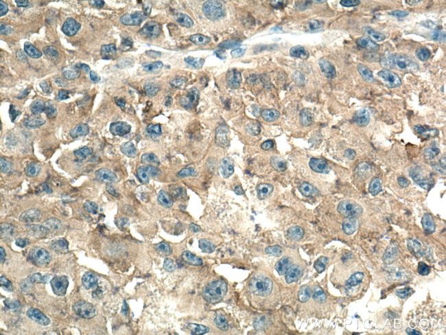 AMPD2 Antibody in Immunohistochemistry (Paraffin) (IHC (P))