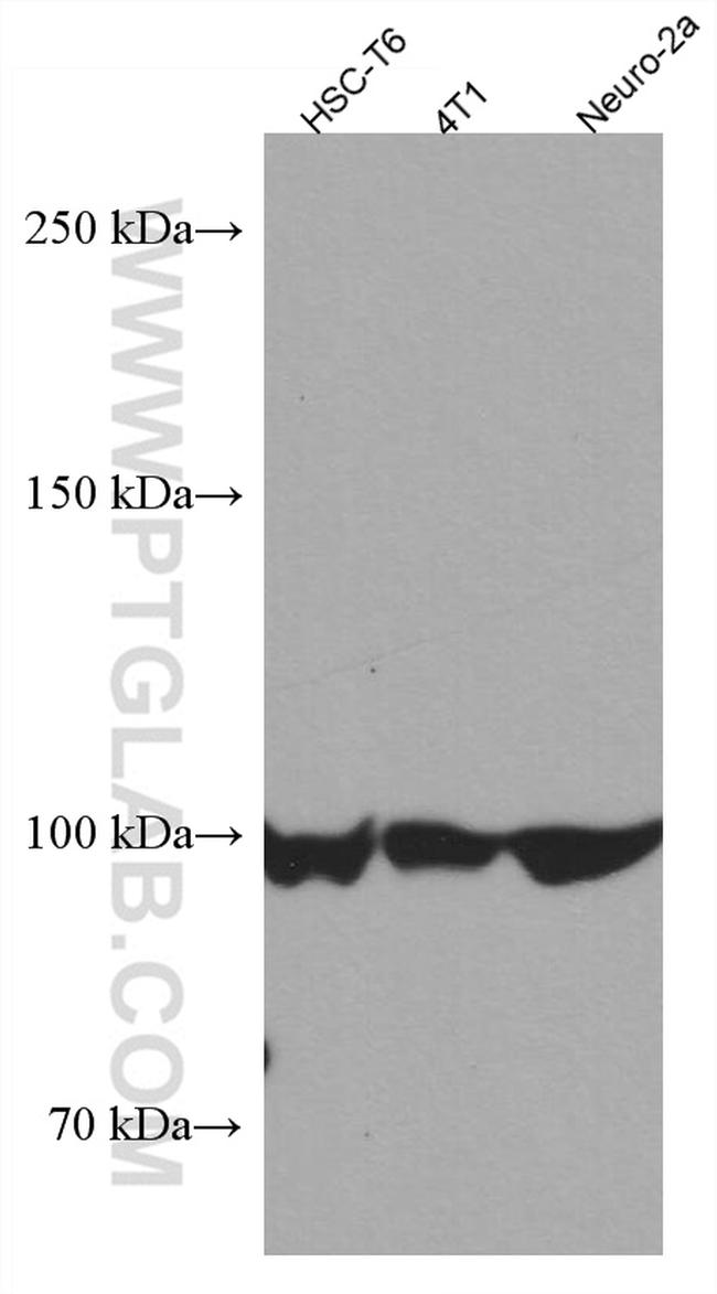 AMPD2 Antibody in Western Blot (WB)