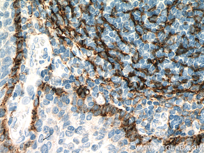 Podoplanin Antibody in Immunohistochemistry (Paraffin) (IHC (P))