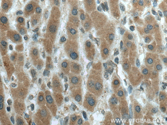 CYP20A1 Antibody in Immunohistochemistry (Paraffin) (IHC (P))