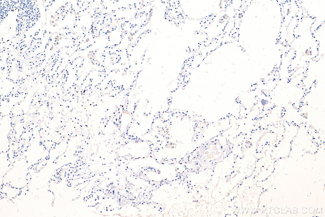 PROX1 Antibody in Immunohistochemistry (Paraffin) (IHC (P))