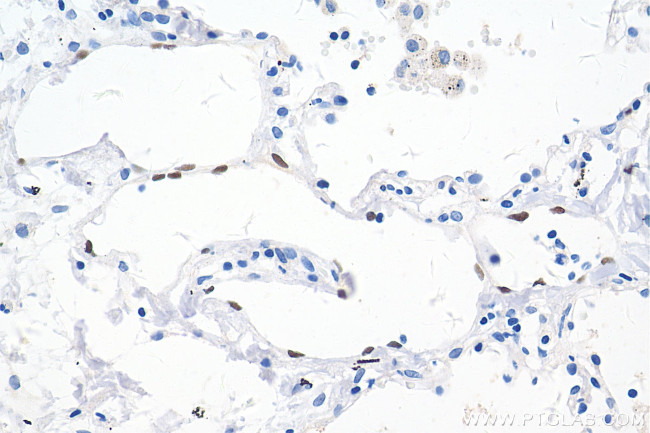 PROX1 Antibody in Immunohistochemistry (Paraffin) (IHC (P))