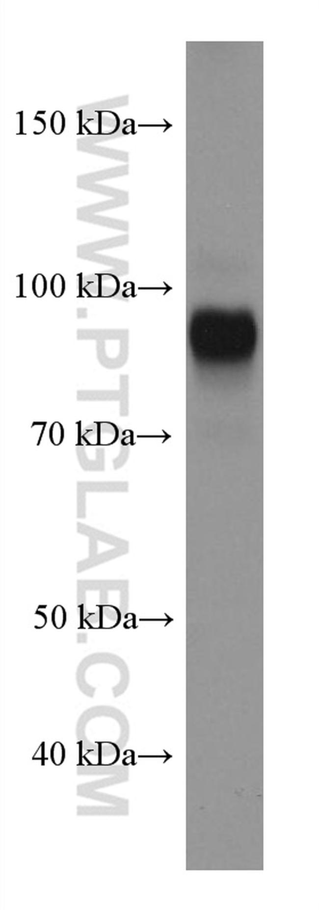 PROX1 Antibody in Western Blot (WB)