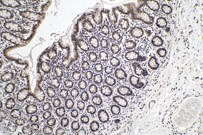 HNRNPA2B1 Antibody in Immunohistochemistry (Paraffin) (IHC (P))