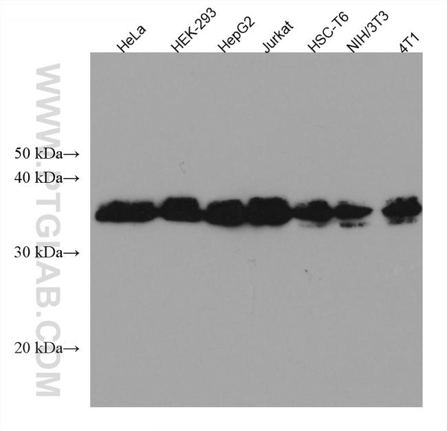 HNRNPA2B1 Antibody in Western Blot (WB)