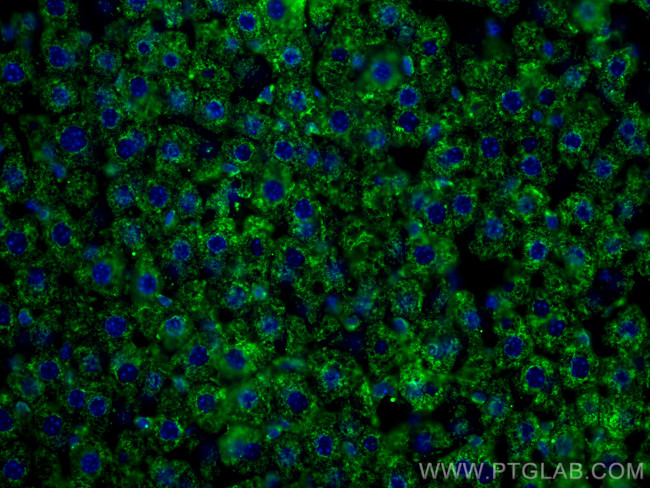 BDH1 Antibody in Immunohistochemistry (Paraffin) (IHC (P))